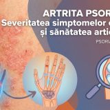 Poza cu piele afectată de psoriazis și articulații inflamate.