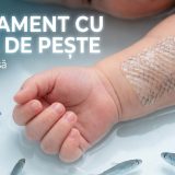 tratament cu piele de pește illustration for Rană mortală a unui bebeluș, vindecată cu un tratament inovator: pielea de pește