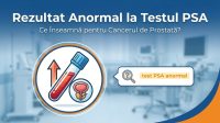 test PSA anormal illustration for Rezultat Anormal la Testul PSA: Ce Înseamnă pentru Cancerul de Prostată?